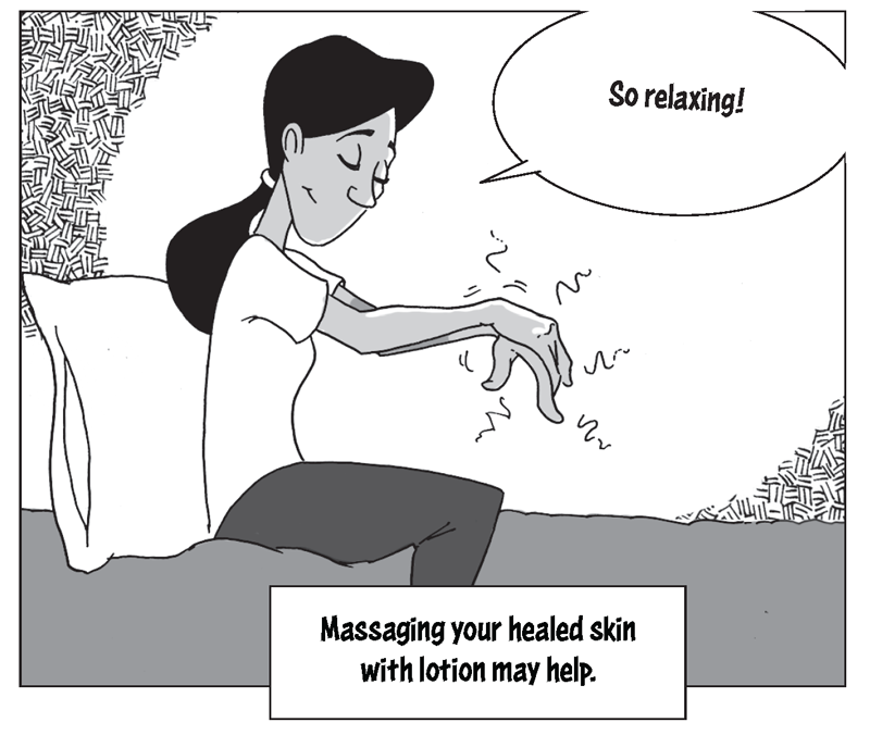 Massaging your healed skin with lotion may help. For example, Jessica is in her room massaging her healed burn with lotion.