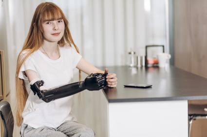 Photo of girl with prosthetic arm